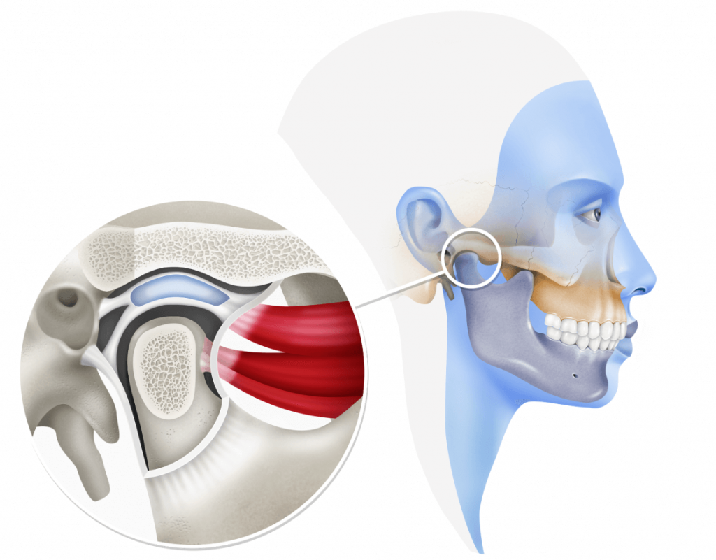 Лечение заболеваний височно-нижнечелюстного сустава